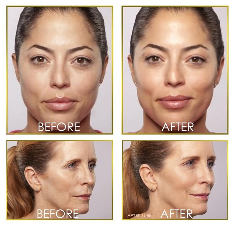 Flawless dermaplane glo hair remover - Image 9