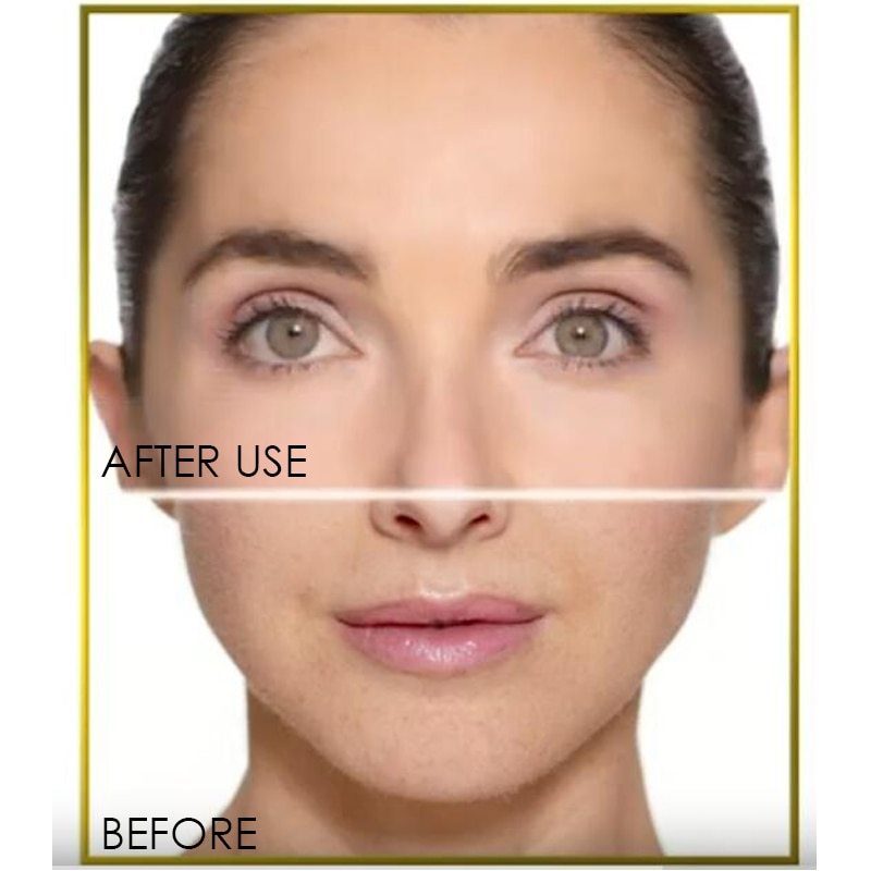 Flawless dermaplane glo hair remover - Image 2